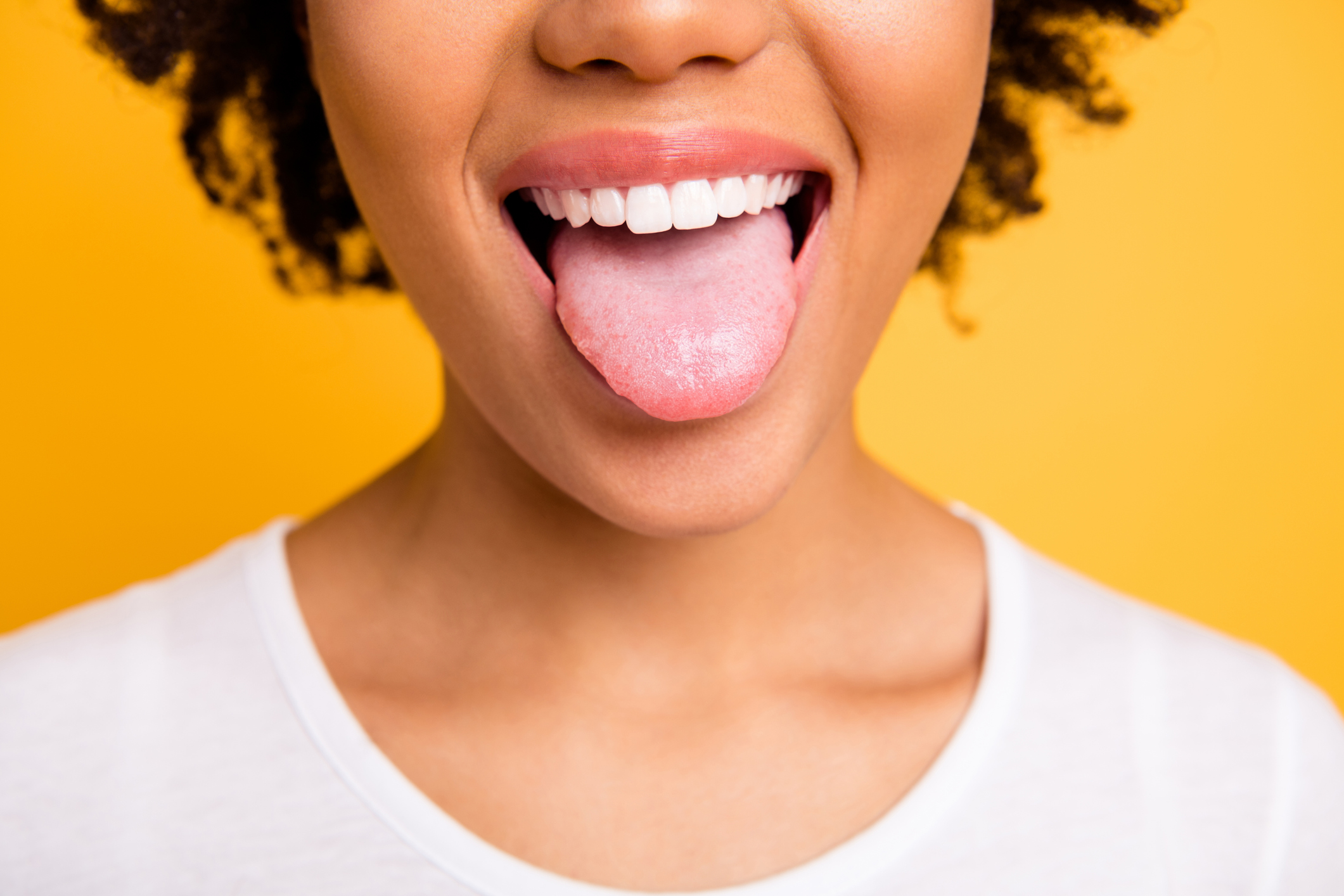 Causas y síntomas de la candidiasis oral