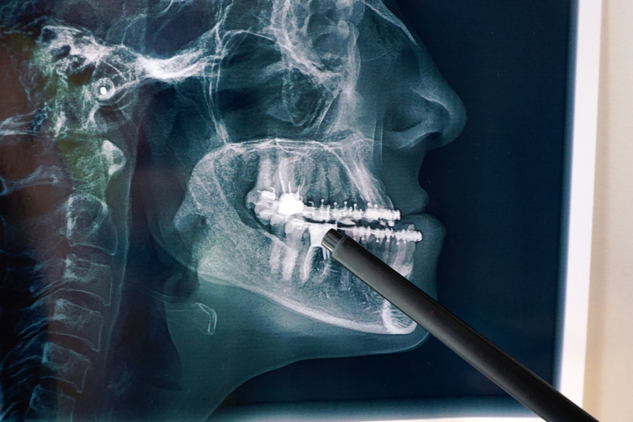 La cirugía maxilofacial, ¿en qué consiste?