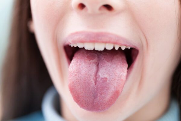 enfermedades de la lengua