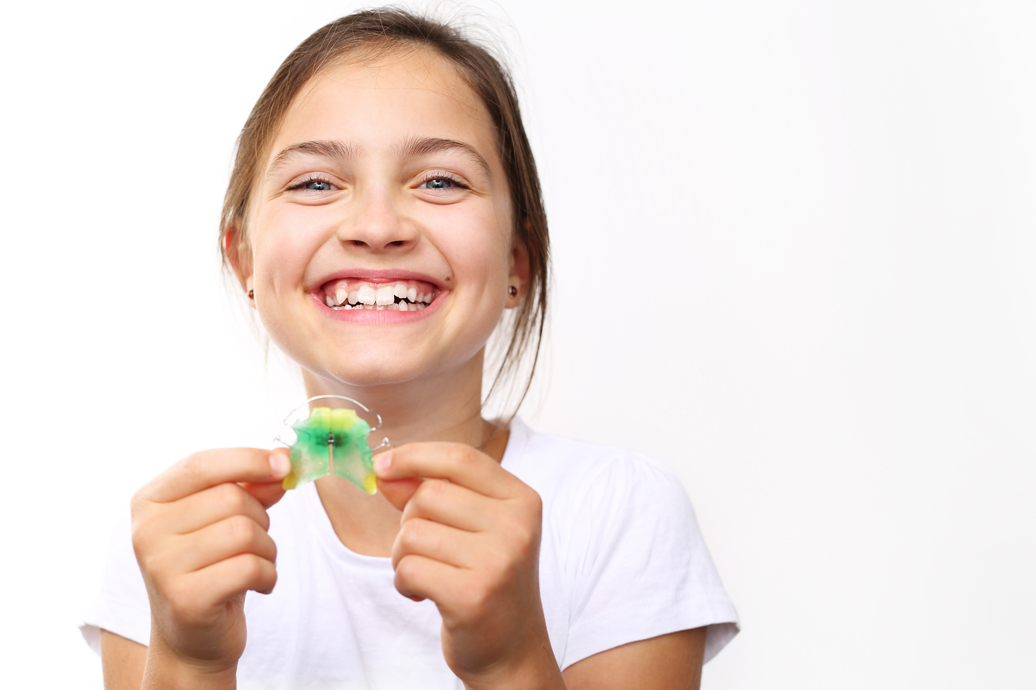Ortodoncia interceptiva: corrigiendo problemas dentales en niños para evitar tratamientos extensos