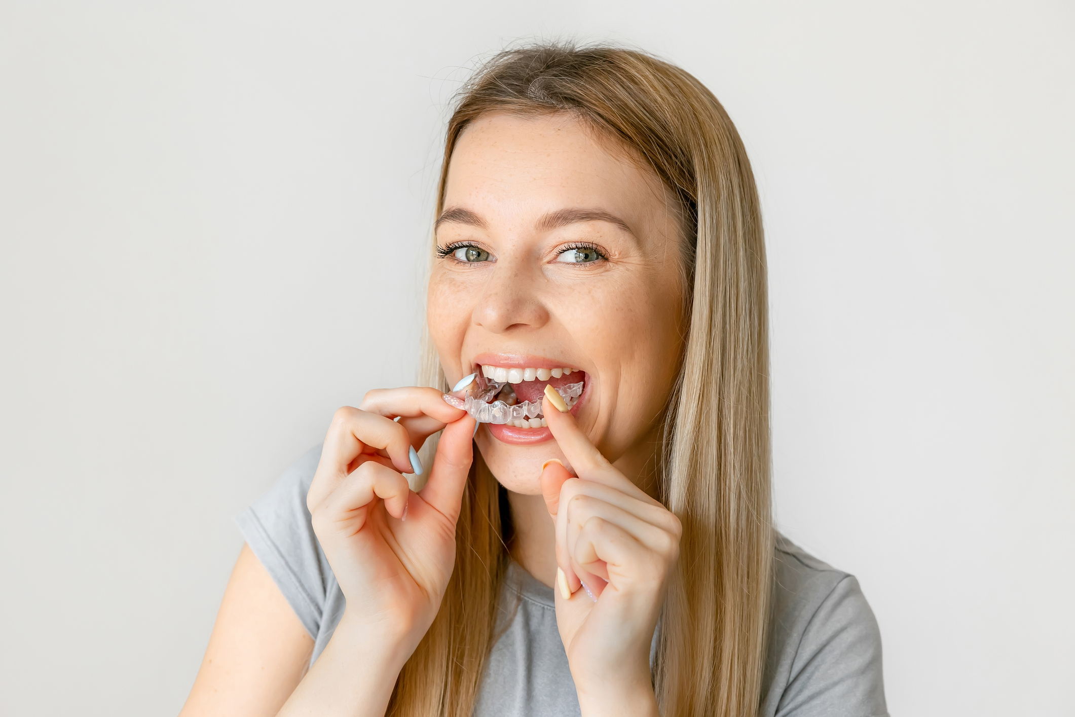 Bruxismo y ortodoncia: cómo afectan los tratamientos dentales a la calidad del sueño